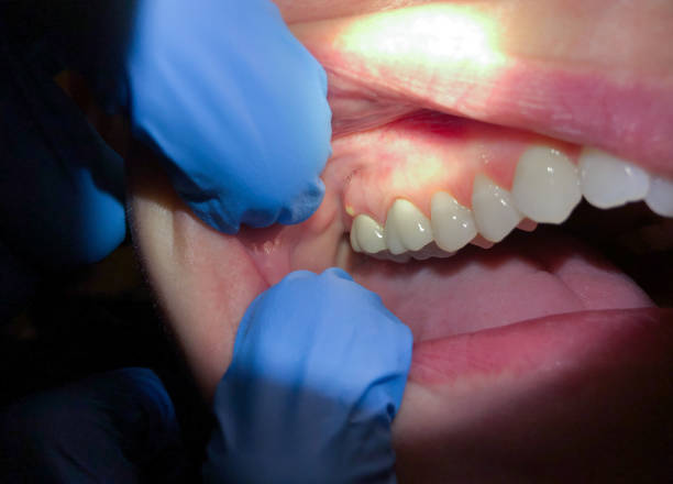 Best Weekend Emergency Dental Services in Purcell, OK